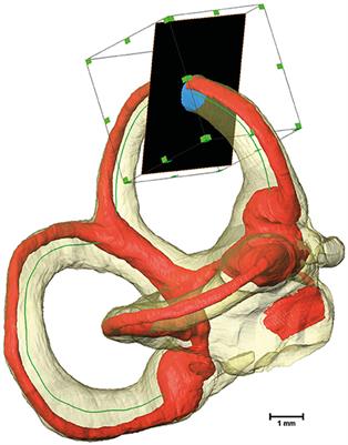 Analysis of Vestibular Labyrinthine Geometry and Variation in the Human Temporal Bone